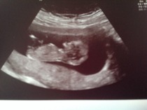 May 2015: Thread 3 - Let's do this :)