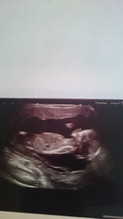 gender scan in the morning :)