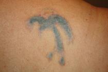 Tattoo artist made a mistake!