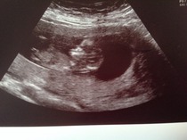 May 2015: Thread 3 - Let's do this :)