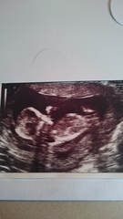 gender scan in the morning :)