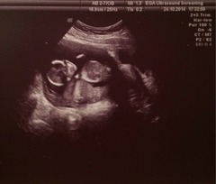 April 2015 #4 - time to start glowing and growing