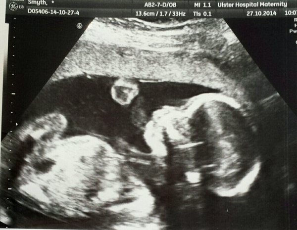 gender prediction?
