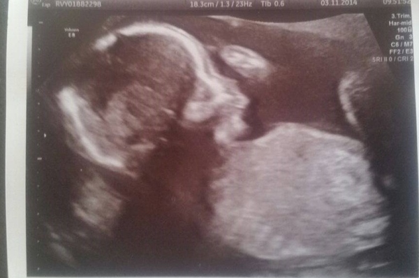 March Mummies 2015 - second tri continues with ever growing bumps, boobs and babies