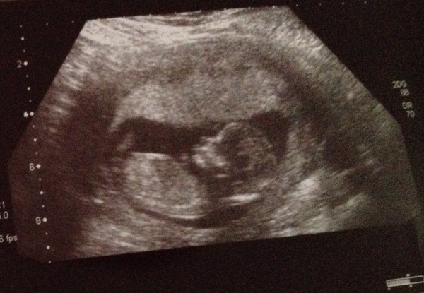 Nub Theory...