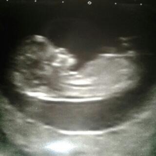 12 week scan!! Any guesses would love to know thoughts!