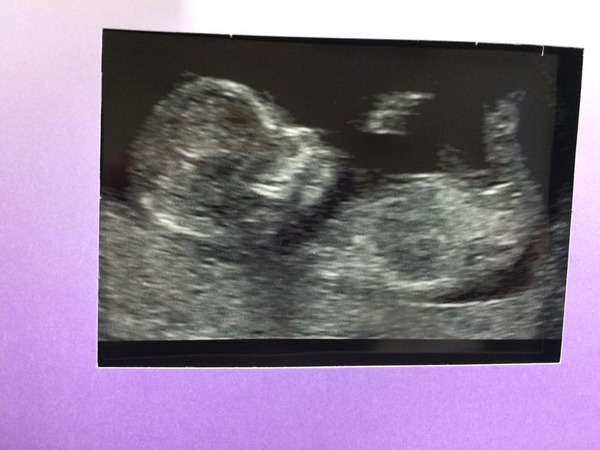 Any good at gender guessing? X