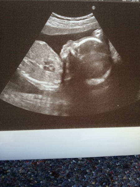 March Mummies 2015 - second tri continues with ever growing bumps, boobs and babies