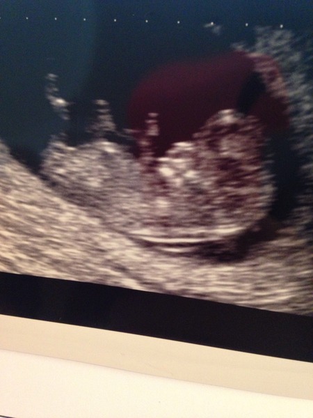 May 2015: Thread 3 - Let's do this :)