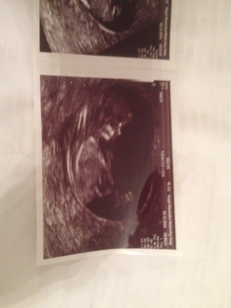 Old bird graduates, gather round....let's talk chicklets!