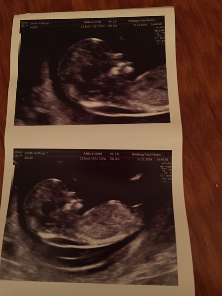 June 2015 Thread 3- Bring on that 2nd Trimester glow!!!