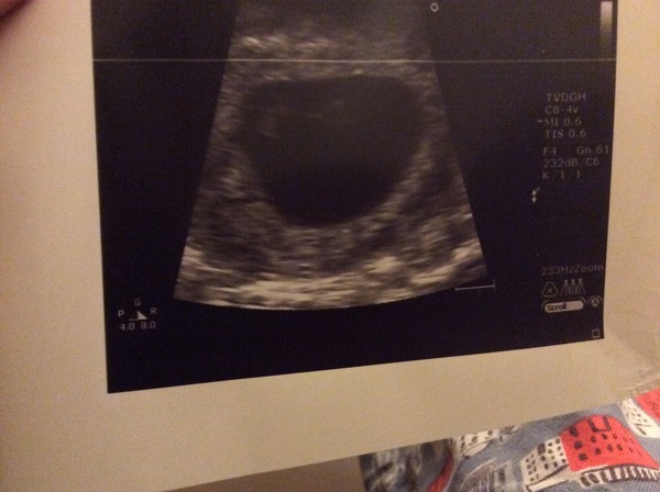 Due-in Due-ly - July thread 2, where the beans turn into beansprouts