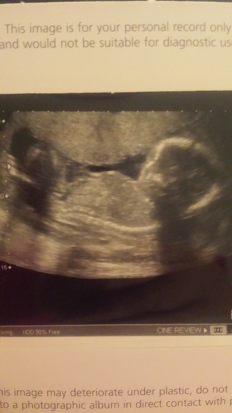 March Mummies 2015 - second tri continues with ever growing bumps, boobs and babies