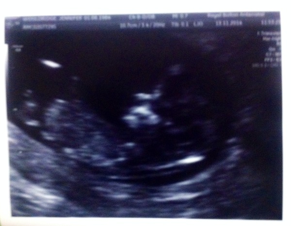 June 2015 Thread 3- Bring on that 2nd Trimester glow!!!