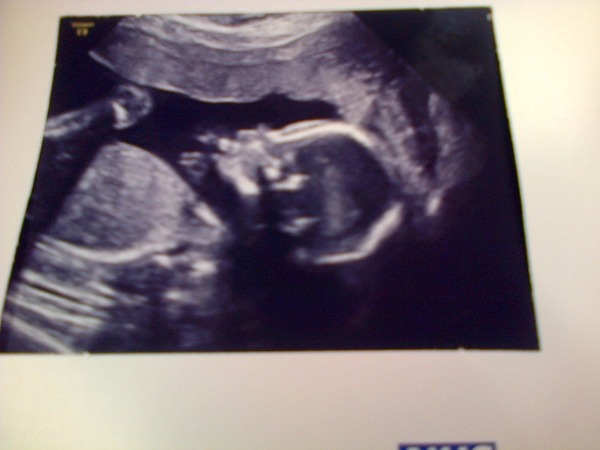 Please guess gender :)