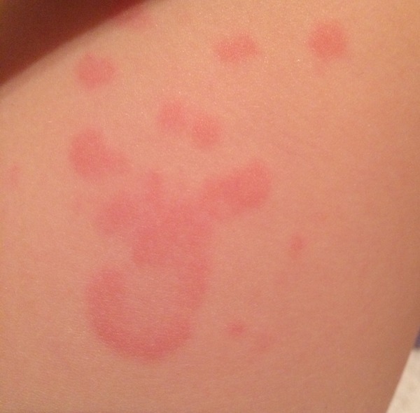 Can anyone identify this rash on DD