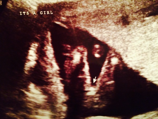 April 2015 #4 - time to start glowing and growing