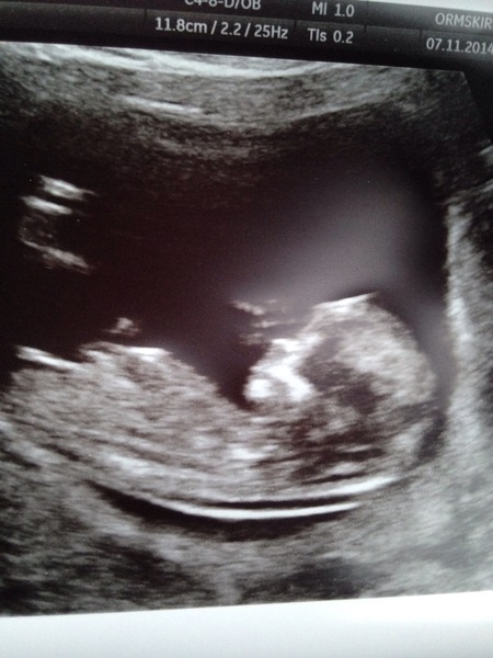 May 2015: Thread 3 - Let's do this :)