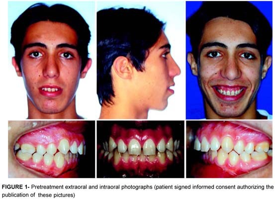 Can lip shape affect teeth?