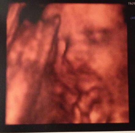 The 'Umm newbie'/ 'Thread maxed out' lovely ladies!