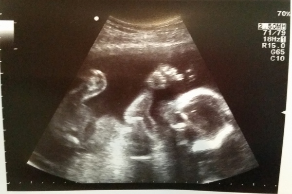 40+ and TTC? Join the club...