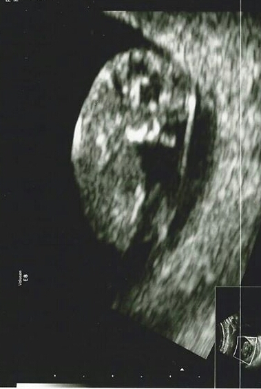 May 2015: Thread 3 - Let's do this :)