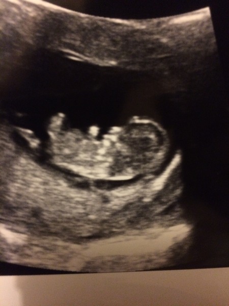 June 2015 Thread 3- Bring on that 2nd Trimester glow!!!