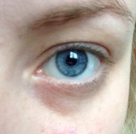 good products to hide dark circles under my eyes?