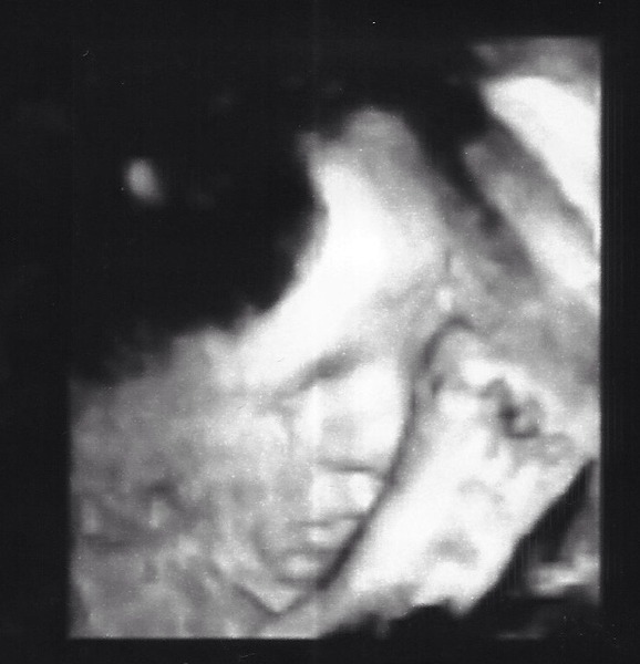 The shiny new Pregnant after MC due December 2014 thread #2