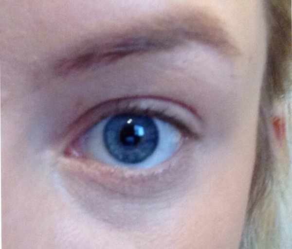 good products to hide dark circles under my eyes?