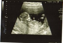 Old bird graduates, gather round....let's talk chicklets!