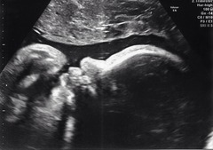 The shiny new Pregnant after MC due December 2014 thread #2