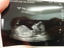 Would you say this is a boy?