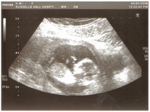 Can you guess the gender?