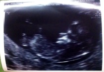 June 2015 Thread 3- Bring on that 2nd Trimester glow!!!