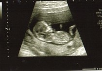 Old bird graduates, gather round....let's talk chicklets!