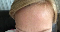 Had secret  botox this morning