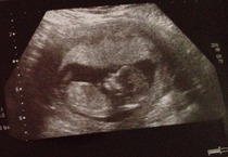 Can you guess the gender?