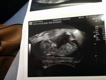 Would you say this is a boy?