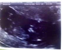 June 2015 Thread 3- Bring on that 2nd Trimester glow!!!