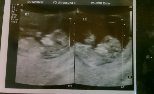 12 week scan today :)