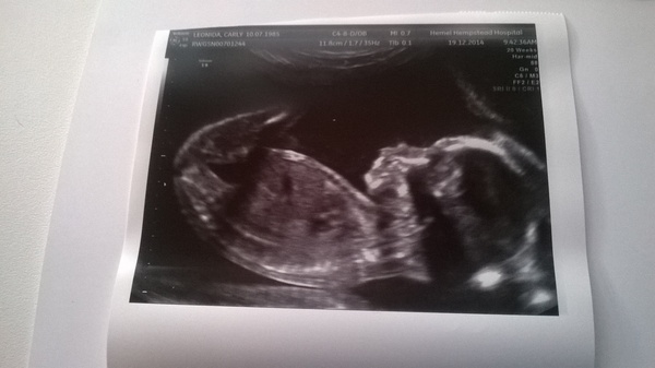 Taking the Plunge: Pregnancy thread