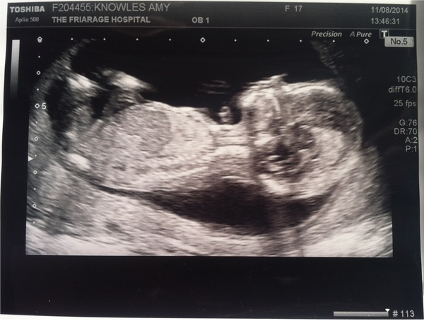 Feb 15, Number 6- Third trimester is ON!