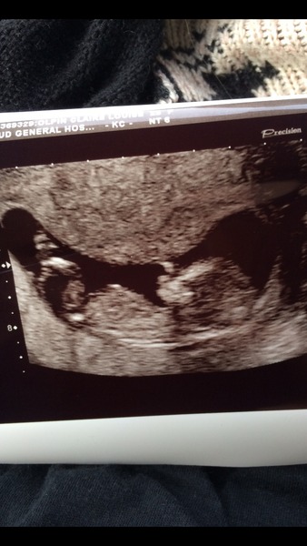 June 2015 - thread 5 - second trimester fast approaching