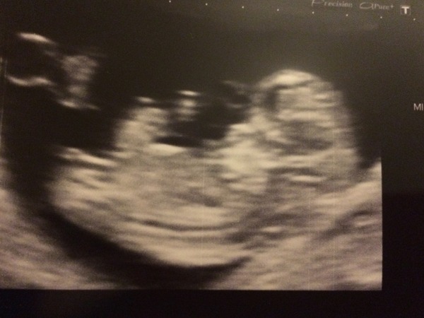 July thread - we are nearing the end of the first trimester, announcements will be made soon!