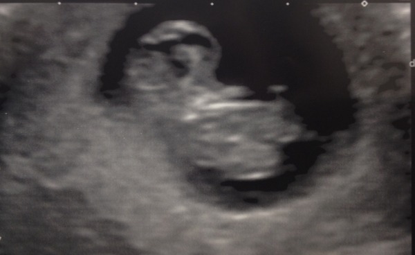 July thread - we are nearing the end of the first trimester, announcements will be made soon!