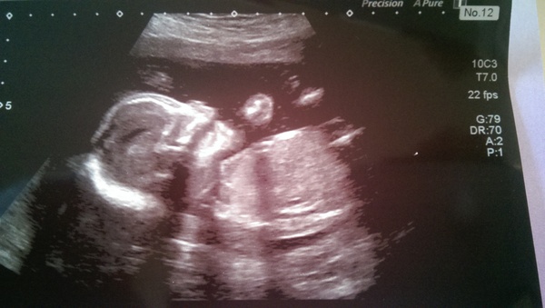 May 2015 - thread 4 - the one where it all gets real!