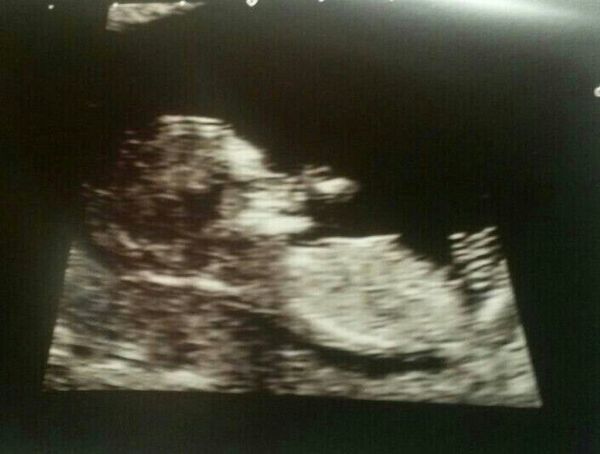 July thread - we are nearing the end of the first trimester, announcements will be made soon!