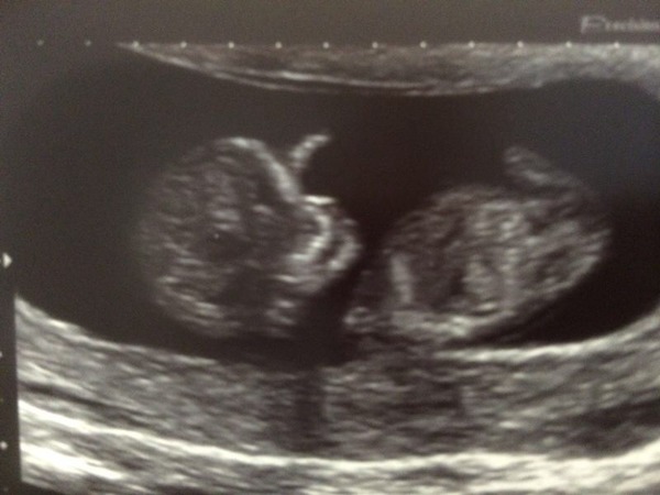 July thread - we are nearing the end of the first trimester, announcements will be made soon!