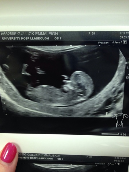 June 2015 - thread 5 - second trimester fast approaching